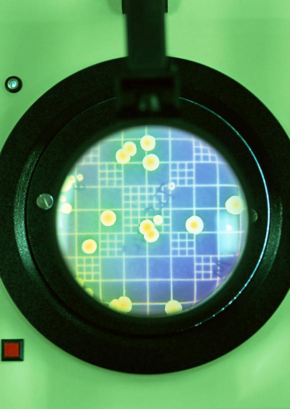 无人,竖图,俯视,室内,特写,白天,实验,仪器,微生物,绿色背景,阴影,研究,反射,分析,化学,细菌,测试,培养皿,影子,紫色,器皿,生物,试验耗材,实验用品,化学器材,生命体,彩图,高角度拍摄,原核生物