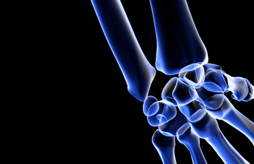 动脉,静脉,骨骼,无人,横图,插画,x光片,室内,特写,白天,正面,数码,科技,静物,阴影,黑色背景,辐射,科学,网络,医学,骨头,高光,几何,计算机图形,合成,图画,画,模型,人体,电脑合成图,数码合成图,骨架,医疗,生物学,科学技术,x射线,手骨,x光,漫画,生理学,写实,具体,具象,桡骨,腕骨,手舟骨,彩图,电磁波,电磁辐射