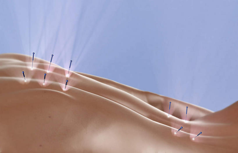 背部,背,无人,横图,插画,室内,特写,白天,正面,数码,科技,静物,一排,阴影,灰色背景,整齐,网络,医学,高光,几何,计算机图形,合成,图画,针,画,排列,人体,电脑合成图,数码合成图,生物学,穴位,队列,针灸,漫画,中医,生理学,写实,具体,具象,彩图