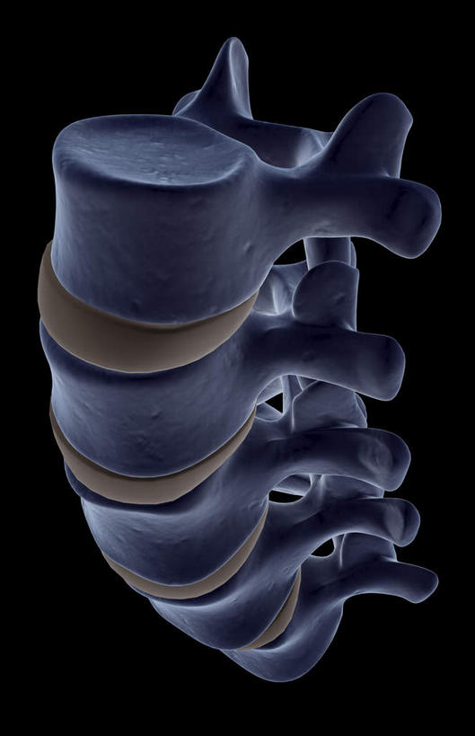 脊髓,骨骼,无人,竖图,x光片,室内,白天,正面,数码,科技,阴影,黑色背景,辐射,科学,网络,医学,骨头,高光,几何,计算机图形,合成,电脑合成图,数码合成图,骨架,医疗,科学技术,x射线,x光,写实,具体,具象,腰椎,脊柱,彩图,电磁波,电磁辐射