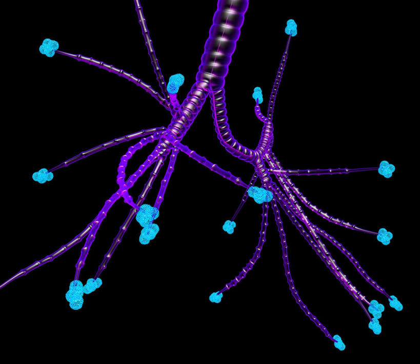 内脏,肺,动脉,静脉,无人,横图,插画,室内,白天,正面,数码,科技,许多,连接,阴影,黑色背景,组合,网络,很多,高光,几何,计算机图形,合成,图画,分开,画,球,蓝色,紫色,模型,分叉,链接,分散,电脑合成图,数码合成图,人体器官,紧固,器官,拼接,拼凑,漫画,支气管,医疗保健,写实,具体,具象,拼合,凑集,聚合,撮合,链结,牢固,支气管树,呼吸系统,肺部,肺脏,接触,彩图