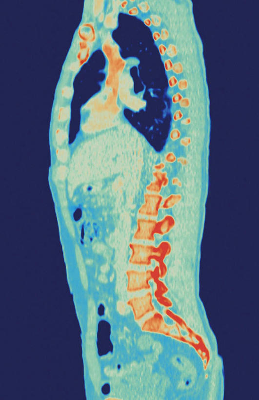 胸,脊髓,骨骼,无人,竖图,室内,白天,正面,机器,数码,科技,阴影,蓝色背景,网络,医学,骨头,高光,几何,计算机图形,合成,设备,蓝色,人体,电脑合成图,数码合成图,骨架,医疗,核磁共振,核磁共振成像,写实,具体,具象,磁共振成像,核磁共振技术,脊柱,胸部,彩图