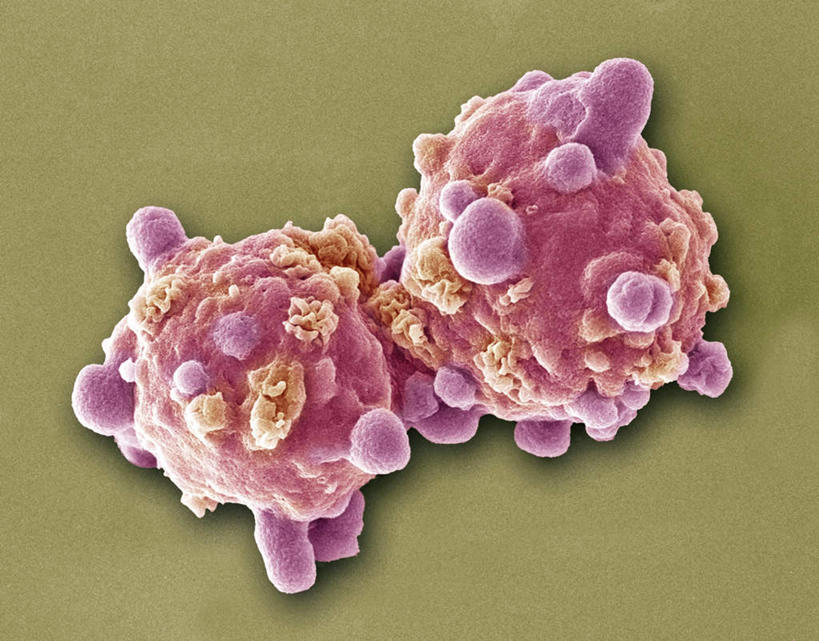 无人,横图,插画,室内,白天,正面,数码,科技,静物,阴影,网络,红血球,医学,细胞,高光,几何,计算机图形,合成,图画,画,两个,红色,人体,褐色背景,电脑合成图,数码合成图,生物学,血细胞,漫画,扣球,生理学,写实,具体,具象,红细胞,彩图