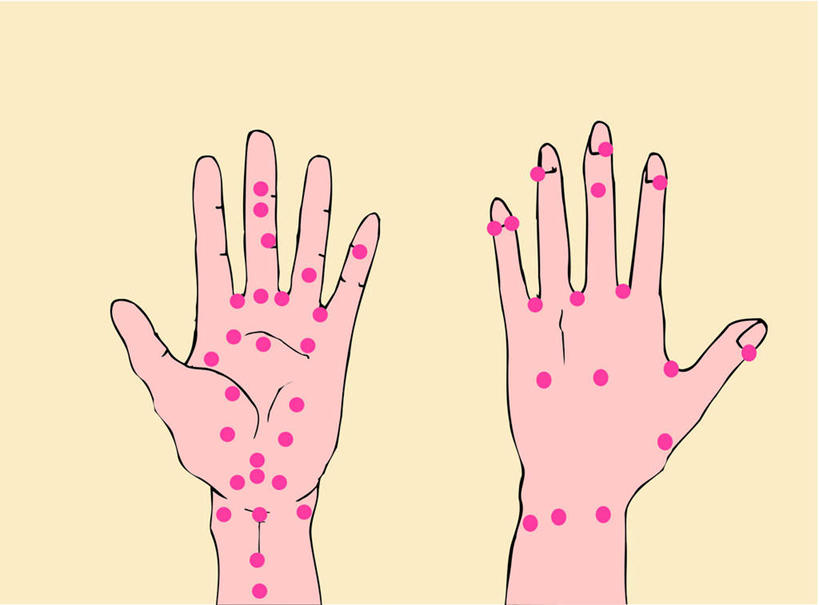 手,手掌,一个人,无人,横图,插画,室内,白天,正面,数码,科技,仅一个人,许多,阴影,黄色背景,网络,医学,斑点,高光,几何,计算机图形,合成,图画,画,排列,红色,手部,经络,经脉,脉络,电脑合成图,数码合成图,医疗,穴位,队列,漫画,写实,具体,具象,腧穴,半身,彩图