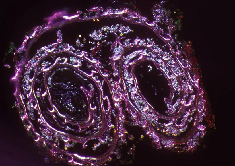 内脏,动脉,静脉,无人,横图,室内,特写,白天,正面,微距,神秘,仪器,微生物,阴影,黑色背景,检查,反射,分析,科学,医学,细胞,显微镜,影子,紫色,观察,清晰,探索,人体,放大,观看,仔细,透镜,生物学,人体器官,优美,凸透镜,聚焦,庄重,器官,高贵,关注,消极,光学,清楚,结肠,冷色,显微图片,自然科学,博物学,生物科学,孤寂,彩图,微距摄影,奢华