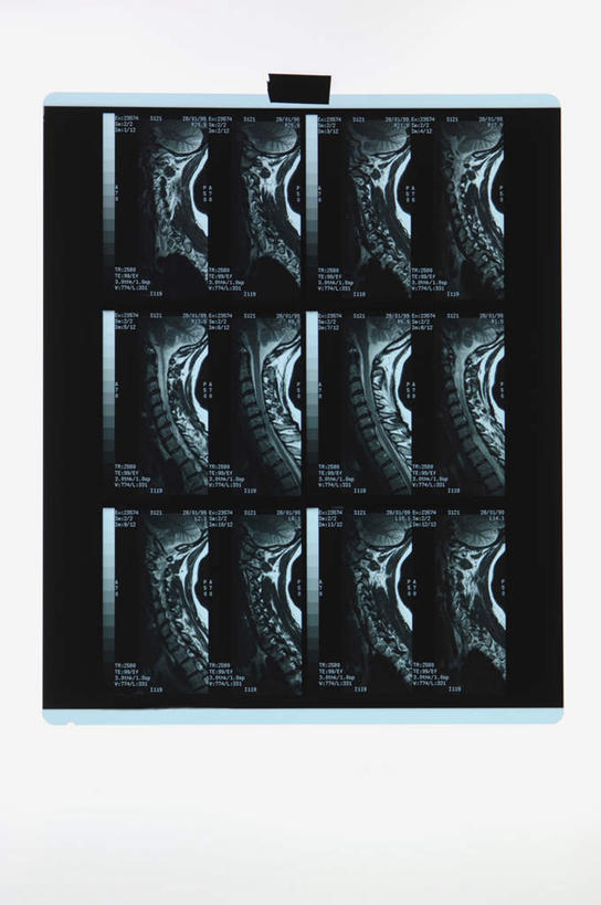 脊髓,骨骼,无人,竖图,x光片,室内,特写,白天,白色背景,正面,静物,一排,整齐,并列,并排,辐射,科学,医学,骨头,排列,摄影,影棚,骨架,医疗,科学技术,x射线,队列,x光,平行,脊柱,彩图,影棚拍摄,拍摄,电磁波,电磁辐射