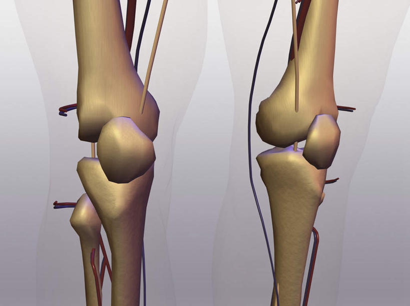 腿部,骨骼,腿,无人,横图,插画,室内,特写,白天,正面,数码,科技,阴影,灰色背景,网络,骨头,高光,几何,计算机图形,合成,图画,画,电脑合成图,数码合成图,骨架,合成图,漫画,写实,具体,具象,髌骨,腓骨,股骨,胫骨,彩图