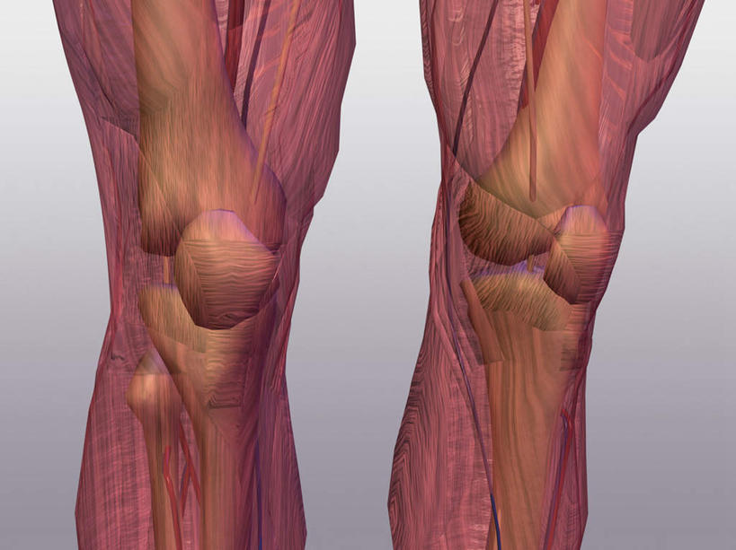 腿部,骨骼,腿,无人,横图,插画,室内,特写,正面,数码,科技,阴影,灰色背景,网络,骨头,高光,几何,计算机图形,合成,图画,画,天,电脑合成图,数码合成图,骨架,合成图,韧带,漫画,写实,具体,具象,髌骨,腓骨,股骨,肌腱,胫骨,彩图