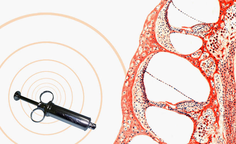 无人,横图,室内,白天,白色背景,正面,抽象,数码,科技,微生物,金属制品,修剪,阴影,科学,网络,医学,金属,工具,剪刀,细胞,线条,同心圆,高光,几何,计算机图形,合成,一个,针管,针筒,夸张,注射,单个,裁剪,电脑合成图,数码合成图,医疗,医疗设备,生物学,注射器,剪子,剪裁,切割,合成图,深奥,手术剪刀,手术剪,彩图
