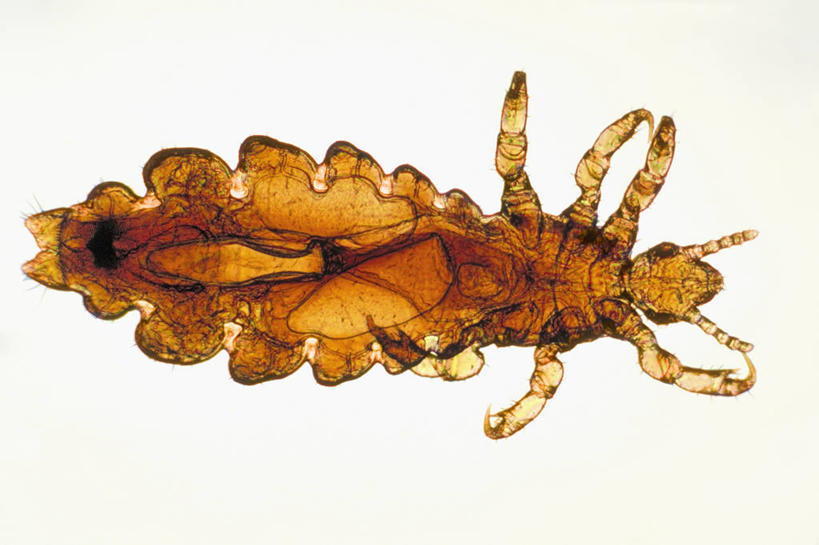 无人,横图,半透明,科学,注视,观察,看,生病,摄影,影棚,观看,察看,生物学,关注,摄影棚,虱子,人虱,彩图,影棚拍摄,拍摄