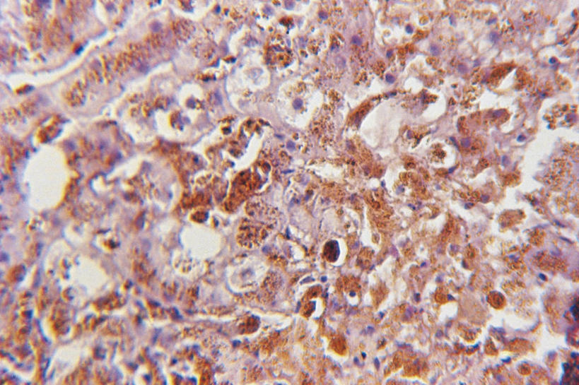 肝脏,无人,横图,插画,特写,绘画,数码,科技,阴影,丰富,艺术,科学,网络,高光,几何,计算机图形,古典,合成,图画,文化,画,粉色,工艺品,品味,生病,人体,摄影,美术,电脑合成图,数码合成图,手术,高雅,合成图,漫画,整形,写实,具体,具象,美学,式样,糖尿病,彩图,全画面,全框架,全帧,外科手术,医疗美容外科手术,整形手术,全画幅