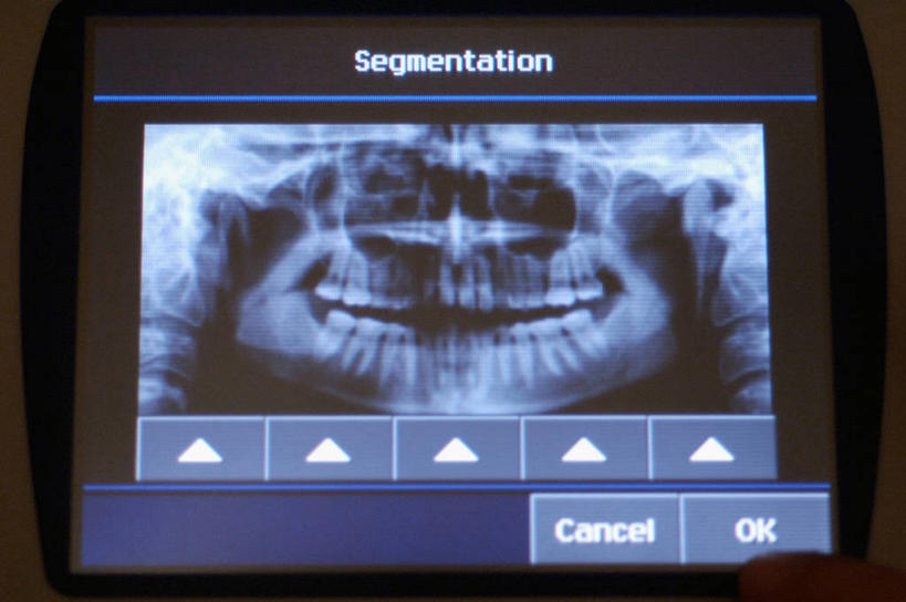 牙齿,无人,横图,x光片,室内,特写,辐射,科学,医学,英格兰,摄影,医疗,科学技术,x射线,x光,齿,牙,牙龈,彩图,电磁波,电磁辐射