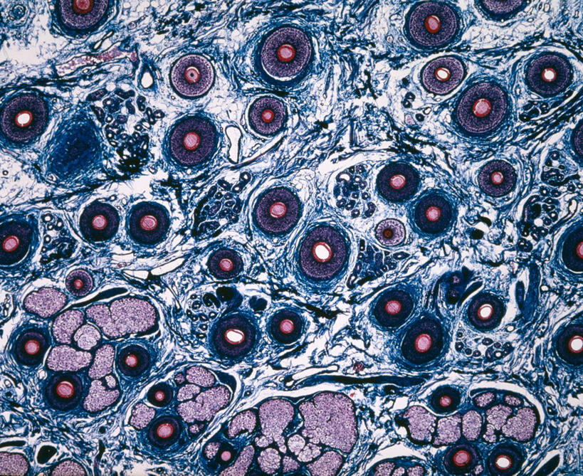 无人,横图,室内,白天,正面,仪器,微生物,检查,反射,分析,科学,医学,纹路,纹理,细胞,显微镜,观察,清晰,探索,放大,观看,皮肤,仔细,透镜,生物学,凸透镜,聚焦,关注,毛球,肌理,光学,清楚,毛囊,显微图片,彩图,扫描电镜,扫描电子显微镜,毛乳头