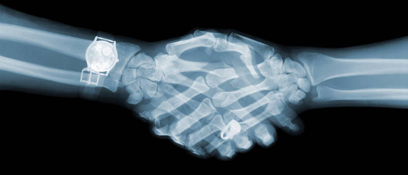 手,无人,两个人,握手,横图,x光片,室内,特写,白天,正面,黑色背景,辐射,科学,医学,手部,单手,医疗,科学技术,x射线,x光,尺骨,肱骨,桡骨,腕骨,掌骨,指骨,男人,男性,年轻男性,搀手,拉手,手拉手,手握手,半身,彩图,电磁波,电磁辐射